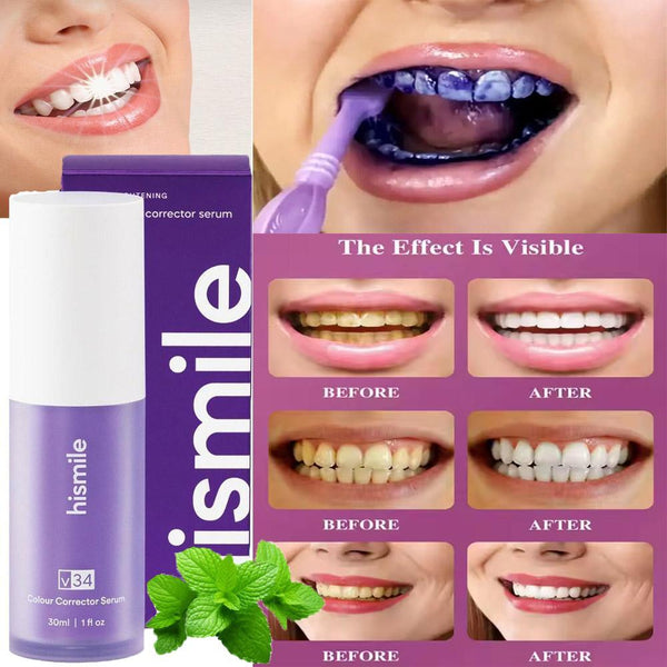 Teeth Whitening Toothpaste Ravi Rang Collection