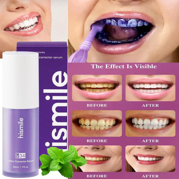 Teeth Whitening Toothpaste Ravi Rang Collection