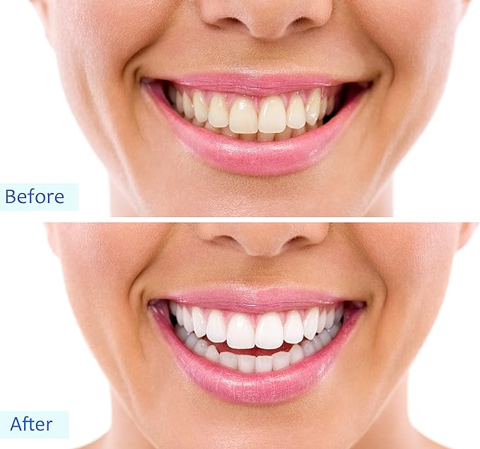 Activated Char coal Powder Teeth Whitening, Skin Detox, Facial Mask & Internal Cleanse- 60g Zainsar