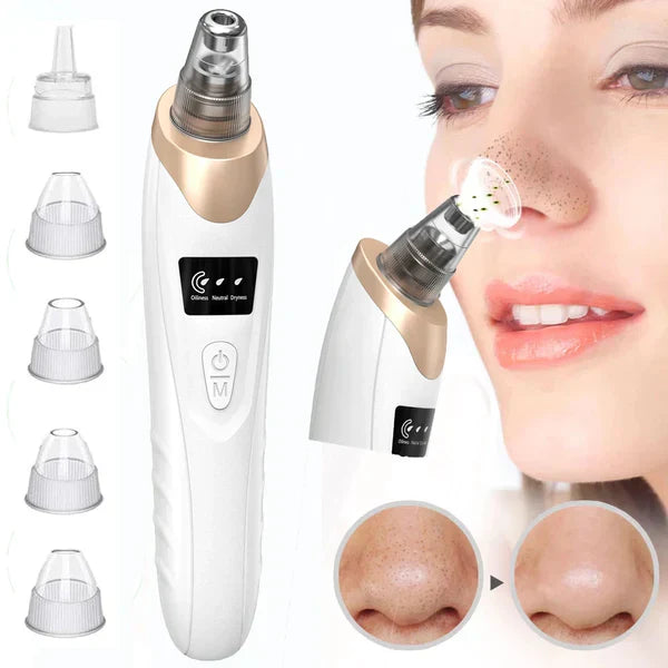 Electric Blackhead Remover Pore Vacuum Sucction machine sab lejao