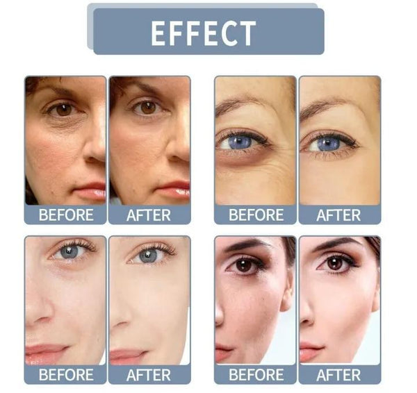 Trimo Skin Whitening Serum Nexasim